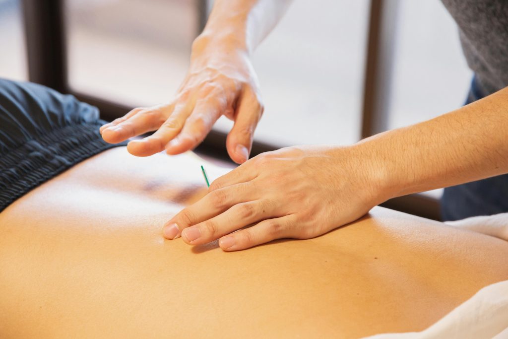 Fysiotherapeut voert dry needling uit als behandeling voor spierklachten met dunne naalden in triggerpoints